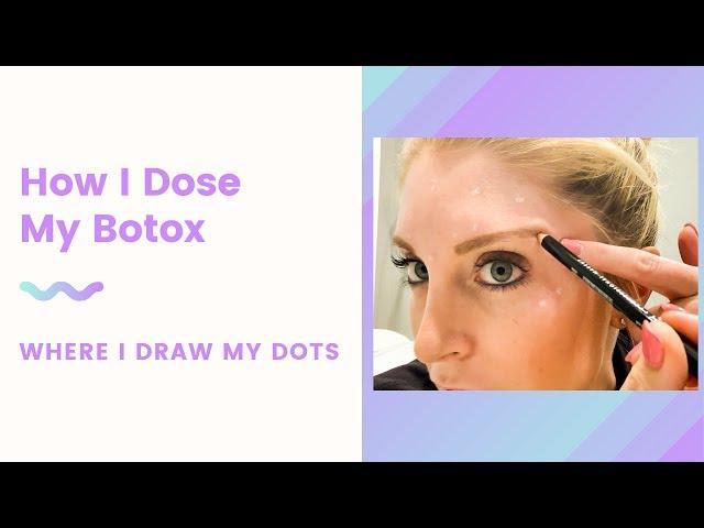 How I Dose my Botox | Where I Draw My Dots