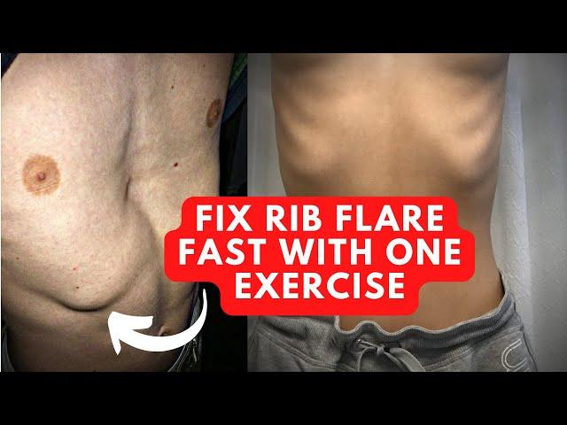 How To Fix Rib Flare With This 1 Powerful Exercise
