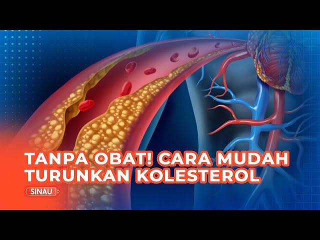 Jangan Diabaikan, Begini Cara Turunkan Kadar Kolesterol Tanpa Obat Menurut Ahli