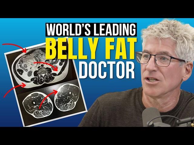 Visceral Fat Doctor: The 4 Types of Belly Fat & How to Lose it for Good - Dr. Sean O’Mara