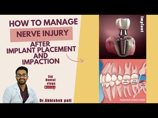 HOW TO MANAGE NERVE INJURY AFTER PLACING IMPLANTS