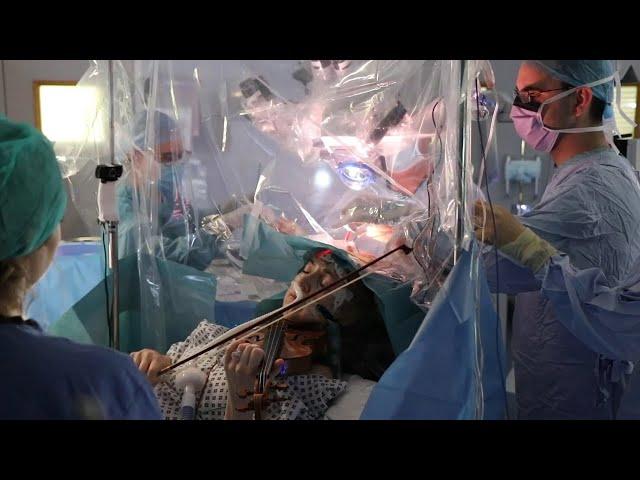 Surgical feat: Brain tumour removed while patient plays violin