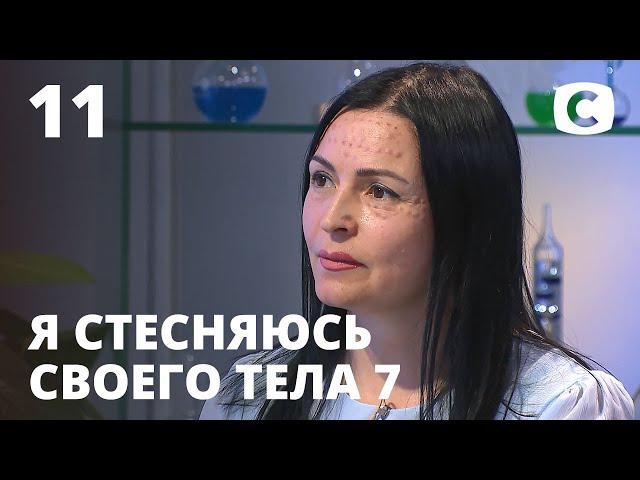 Я стесняюсь своего тела. Сезон 7. Выпуск 11 от 06.12.2020