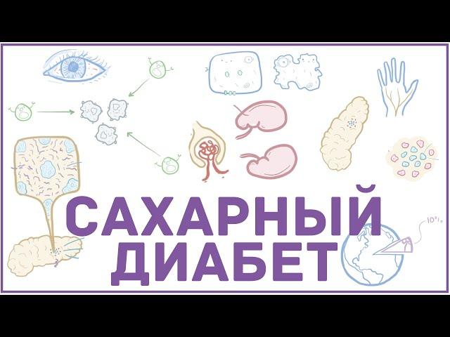 Сахарный диабет - 1 и 2 тип, причины, симптомы, кетоацидоз, гиперосмолярная гипергликемия