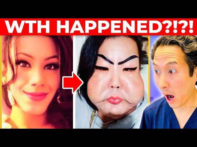 Botched Surgery Gone WILD! JUJU DO PIX! Extreme Bodies Explained!