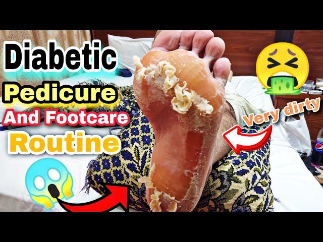 Diabetic Pedicure Tutorial and Foot Care Routine and home  Footcare33