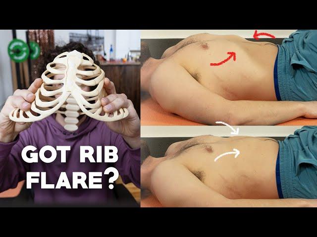 Rib Flare - Why you can't FIX it!