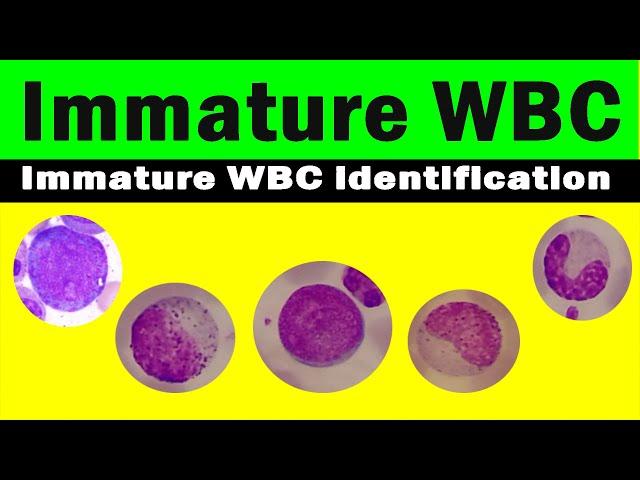 How to differentiate immature WBC | immature WBC identification | Hematology