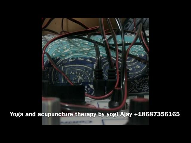 Yoga and acupuncture therapy by yogi Ajay