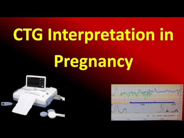 Interpretation of Cardiotocography for Assessment of Fetal Wellbeing, NICE Guideline