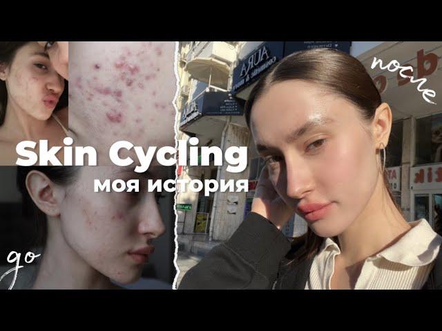 КАК Я ИЗБАВИЛАСЬ ОТ ПРЫЩЕЙ ЗА МЕСЯЦ | Skin Cycling