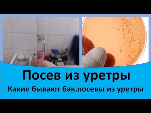 Посевы из уретры.  Какие бывают бак посевы из уретры.