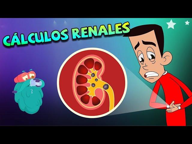 Cálculos Renales y lo que debes saber | Educativos para niños