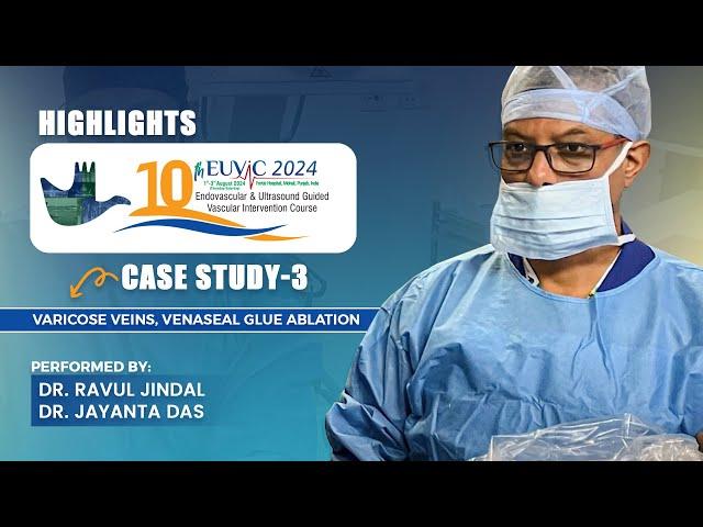 Varicose Veins, Venaseal Glue Ablation | 10th EUVIC 2024 | Dr Ravul Jindal | Dr Jayanta Das