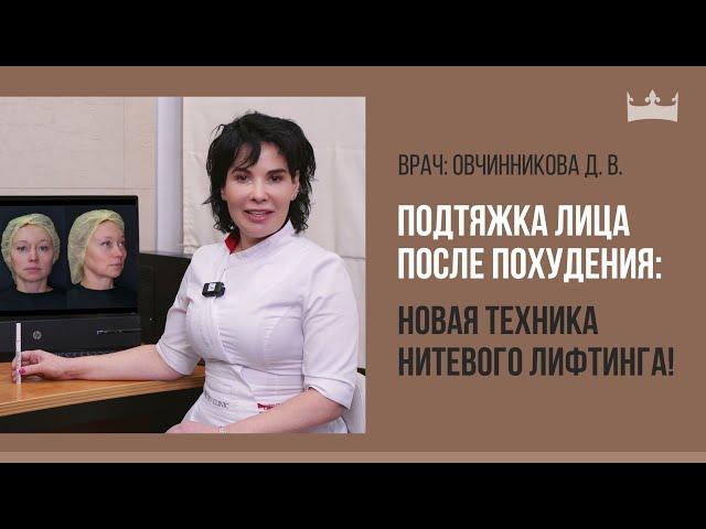 Подтяжка лица после похудения: новая техника нитевого лифтинга!