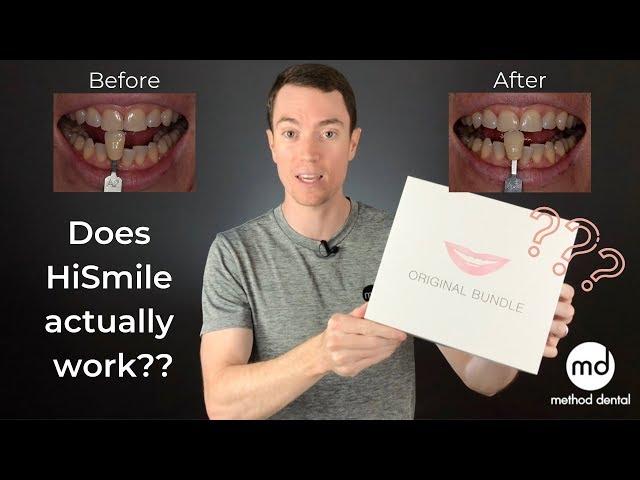 HiSmile Review By A Dentist, Dr. Grant McGrath