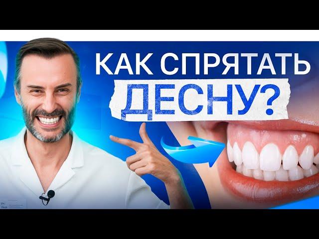 Десневая улыбка. Кто поможет – ортодонт, хирург или косметолог?