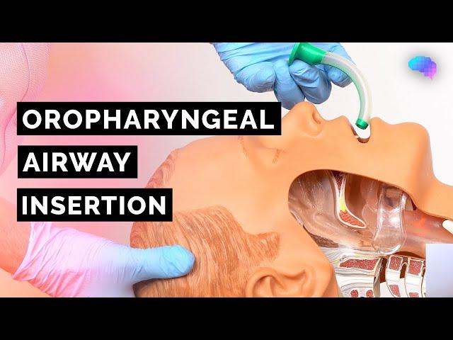 Oropharyngeal Airway Insertion | Guedel | OPA | ABCDE Emergency | OSCE Guide | UKMLA | CPSA