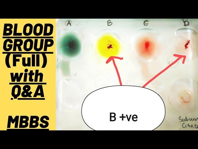 Blood Group Practical (Full) with Question & answers| MUHS | #mbbs #medicine #aiims #physiology