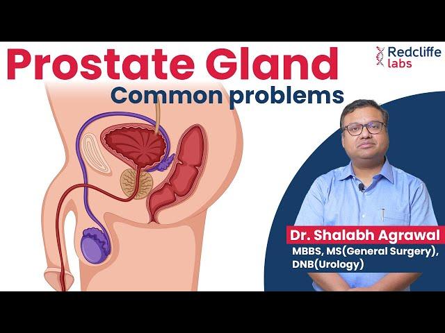  Prostate Gland and Urinary Problems Home Remedies |  Prostate Gland Problems Symptoms & Treatment