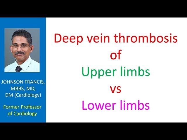 Deep vein thrombosis of upper limbs vs lower limbs