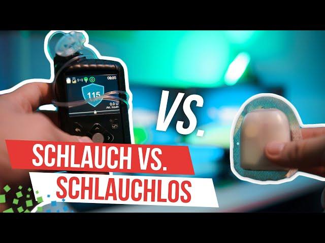 Insulinpumpe mit Schlauch vs. Patch-Pumpe