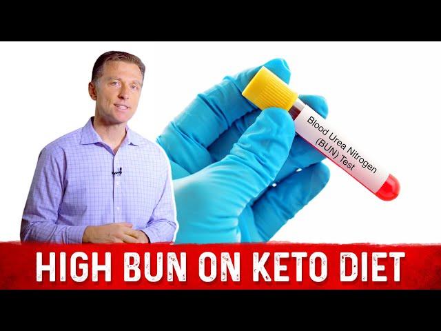 High Levels of BUN (Blood Urea Nitrogen) on a Ketogenic Diet – Dr. Berg