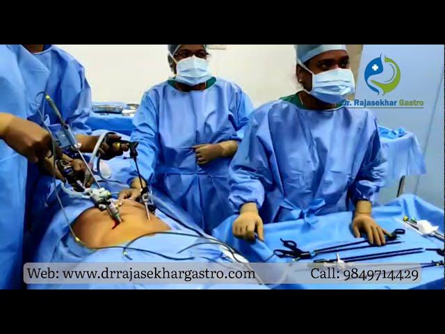 Laparoscopic Cholecystectomy – Removal of the gallbladder - Dr G Rajasekhar Reddy