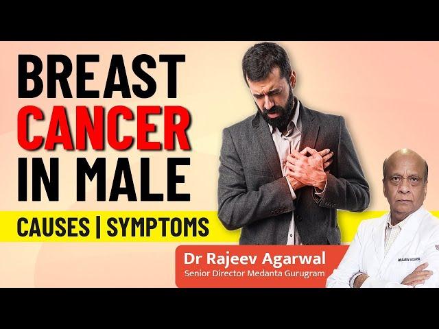 Breast Cancer in Male | Causes and Symptoms of Breast Cancer in Males in Hindi | Dr. Rajeev Agarwal