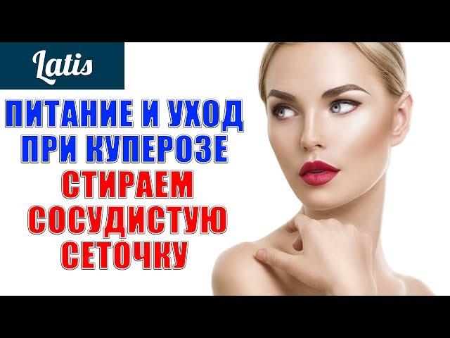 ПИТАНИЕ И УХОД ПРИ КУПЕРОЗЕ - СТИРАЕМ СОСУДИСТУЮ СЕТОЧКУ