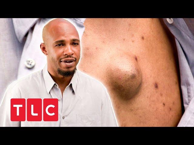 "Meine Kinder ekeln sich vor mir" | Dr. Pimple Popper | TLC Deutschland