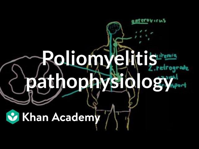 Poliomyelitis pathophysiology | Infectious diseases | NCLEX-RN | Khan Academy