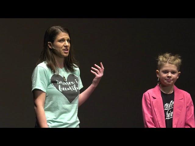 Intersex is Awesome | Kristina Turner & Ori Turner | TEDxWWU