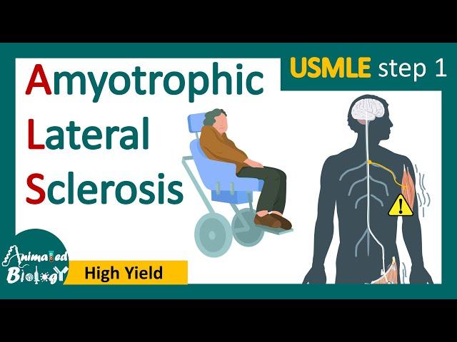 Amyotrophic lateral sclerosis (ALS) | Lou Gehrig's disease | Symptoms, pathophysiology & management