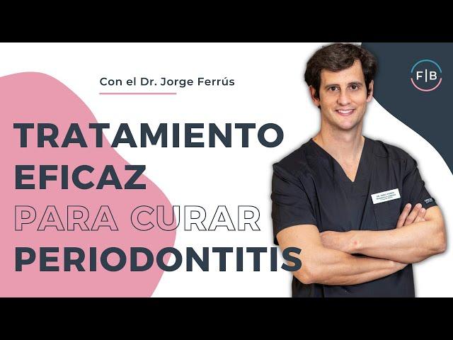  PERIODONTITIS o PIORREA: Tratamiento eficaz para CURAR tus ENCÍAS 