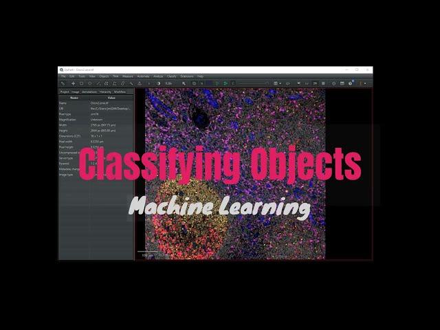 QuPath: Classifying Objects 2 [Machine Learning]