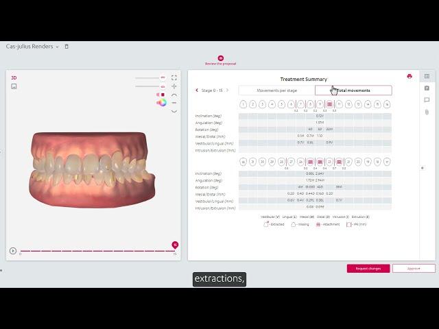 3Shape Treatment Review - Treatment proposal and summary (TRIOS Users)