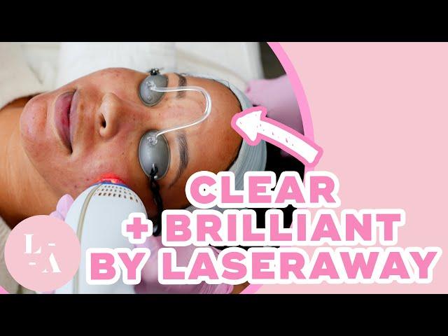 Why You Need Clear + Brilliant! Watch this Treatment in Action!