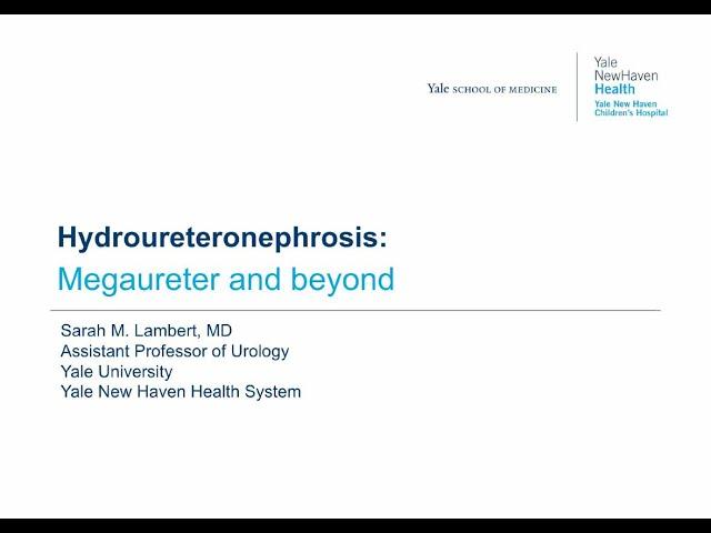 5.28.2020 Urology COViD Didactics - Hydroureteronephrosis: Megaureter and Beyond