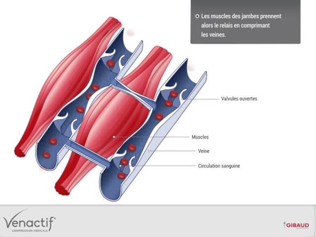 Guide Pathologie - Insuffisance veineuse