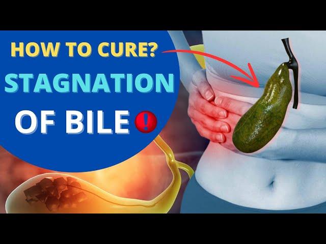 HOW to get rid of BILE CONGESTION in 5 minutes?They Won't Tell You This in the Hospital!