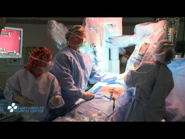 Robot-Assisted Single-Site Gallbladder Removal (Full-Length Surgery)