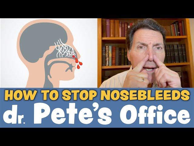 How to stop bloody nose? | Dr. Pete's Office