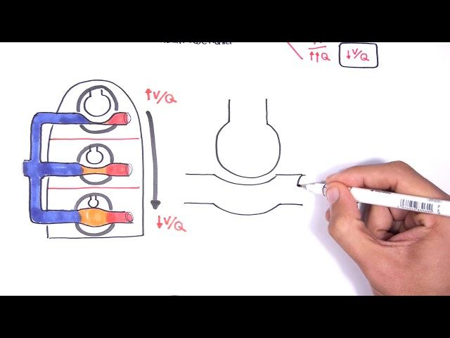 Respiratory System Physiology - Ventilation and Perfusion (V:Q Ratio) Physiology