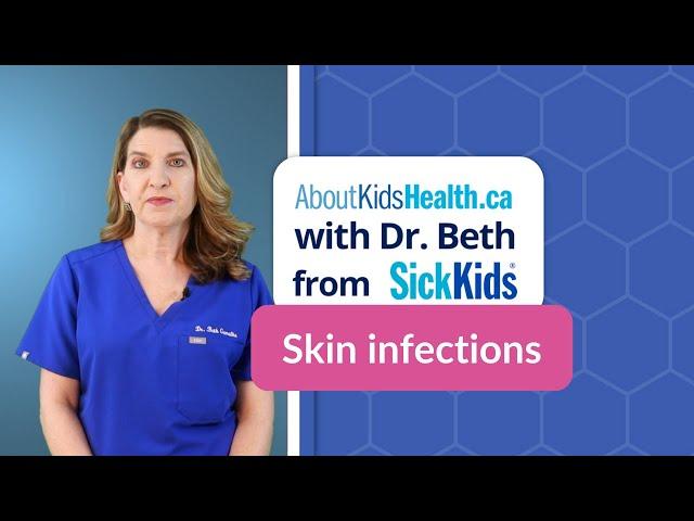 Skin infections: Five common skin infections and how to treat them