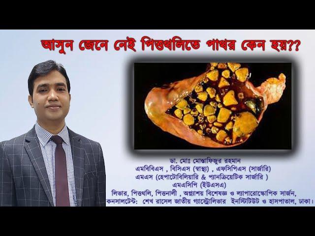 আসুন, জেনে নেই, পিত্তথলিতে পাথর কেন হয়?? Dr.Mustafizur Rahman