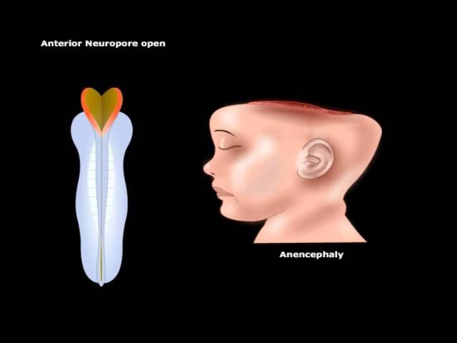 USMLE® Step 1: Neuroscience: Development of CNS Animation