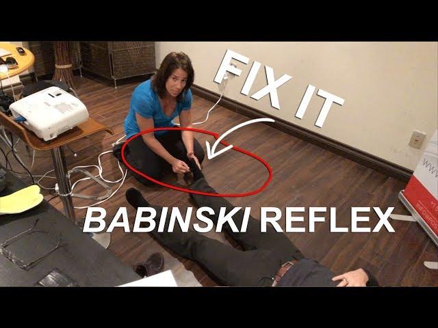 Babinski Reflex Test and Fix / in an adult |  Posturepro