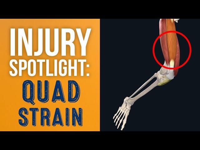 What is a Quad Strain?