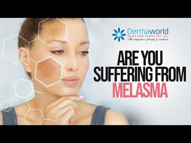 Suffering from Melasma, Here's the solution!